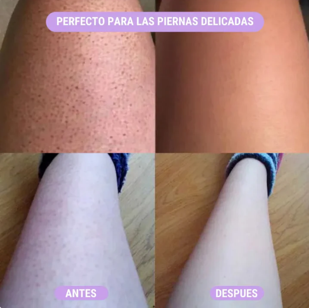Depiladora con Sensor Láser + Depiladora Facial Ultrafina de REGALO