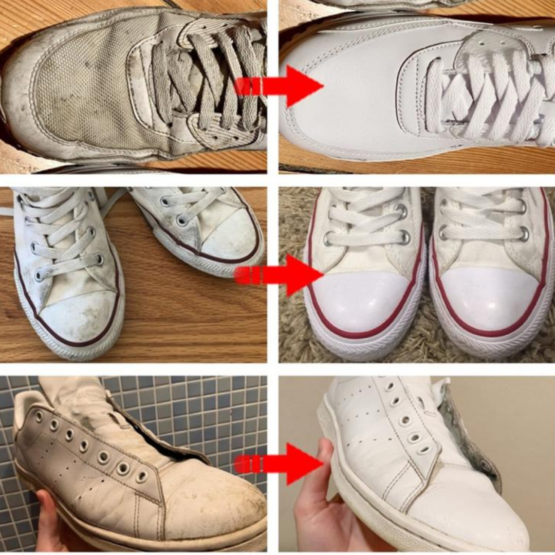 ZapaRescue™ – No tires tus zapatillas favoritas 2X1