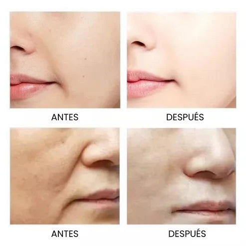 Oro de Ginseng™: el suero que rejuvenece tu piel en semanas, sin tratamientos caros ni complicaciones.
