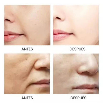 Oro de Ginseng™: el suero que rejuvenece tu piel en semanas, sin tratamientos caros ni complicaciones.