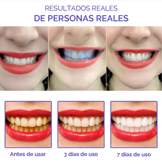 Obsessive™ Pasta Dental Blanqueadora – Sonrisa blanca sin gastar de más