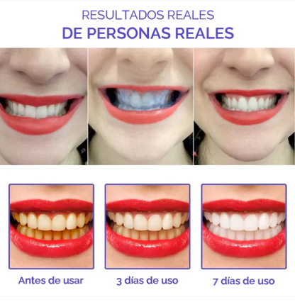 Obsessive™ Pasta Dental Blanqueadora – Sonrisa blanca sin gastar de más