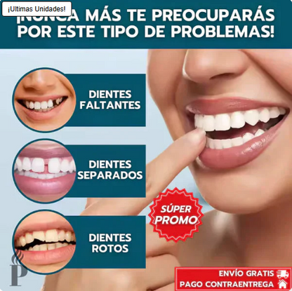 Carillas Instant Smile™: ocultan manchas, espacios y torceduras en minutos, desde casa