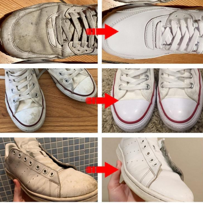 ZapaRescue™ – No tires tus zapatillas favoritas 2X1