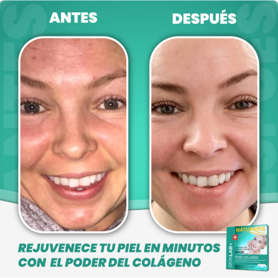 Naturaful™ – Nota el cambio en 14 días (12 parches + Guía Gratis)