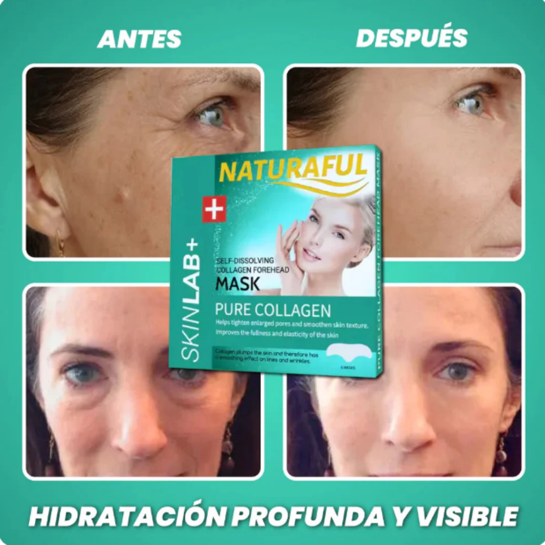 Naturaful™ – Nota el cambio en 14 días (12 parches + Guía Gratis)