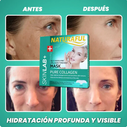 Naturaful™ – Nota el cambio en 14 días (12 parches + Guía Gratis)