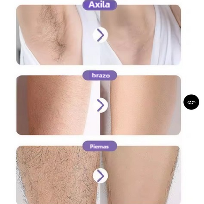 ✨ SmoothSkin™ – Depilador Exfoliante Sin Dolor (30%OFF)