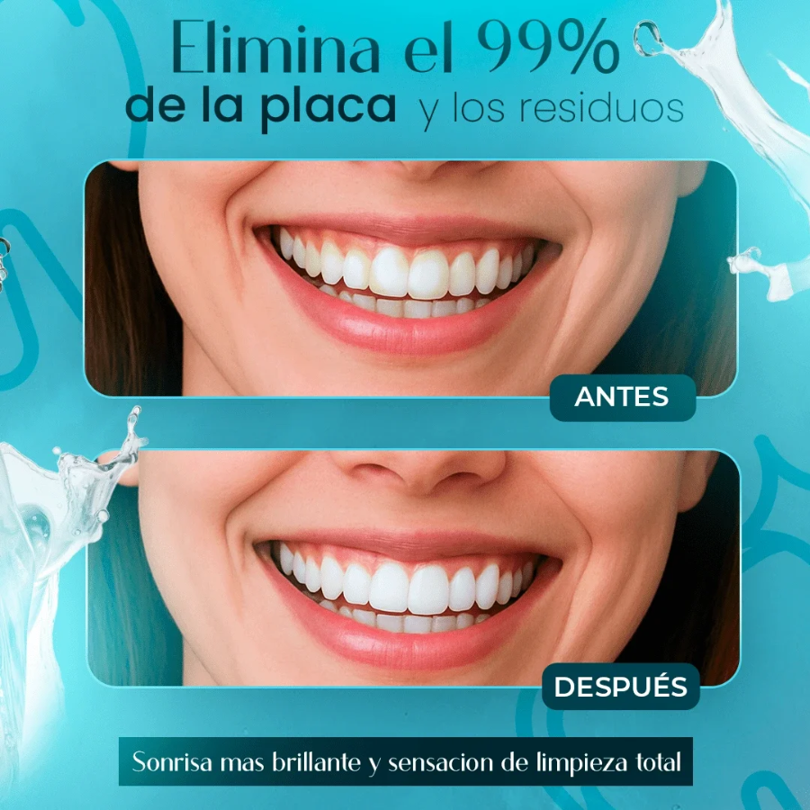 Irrigador Bucal Portátil + 4 Boquillas GRATIS