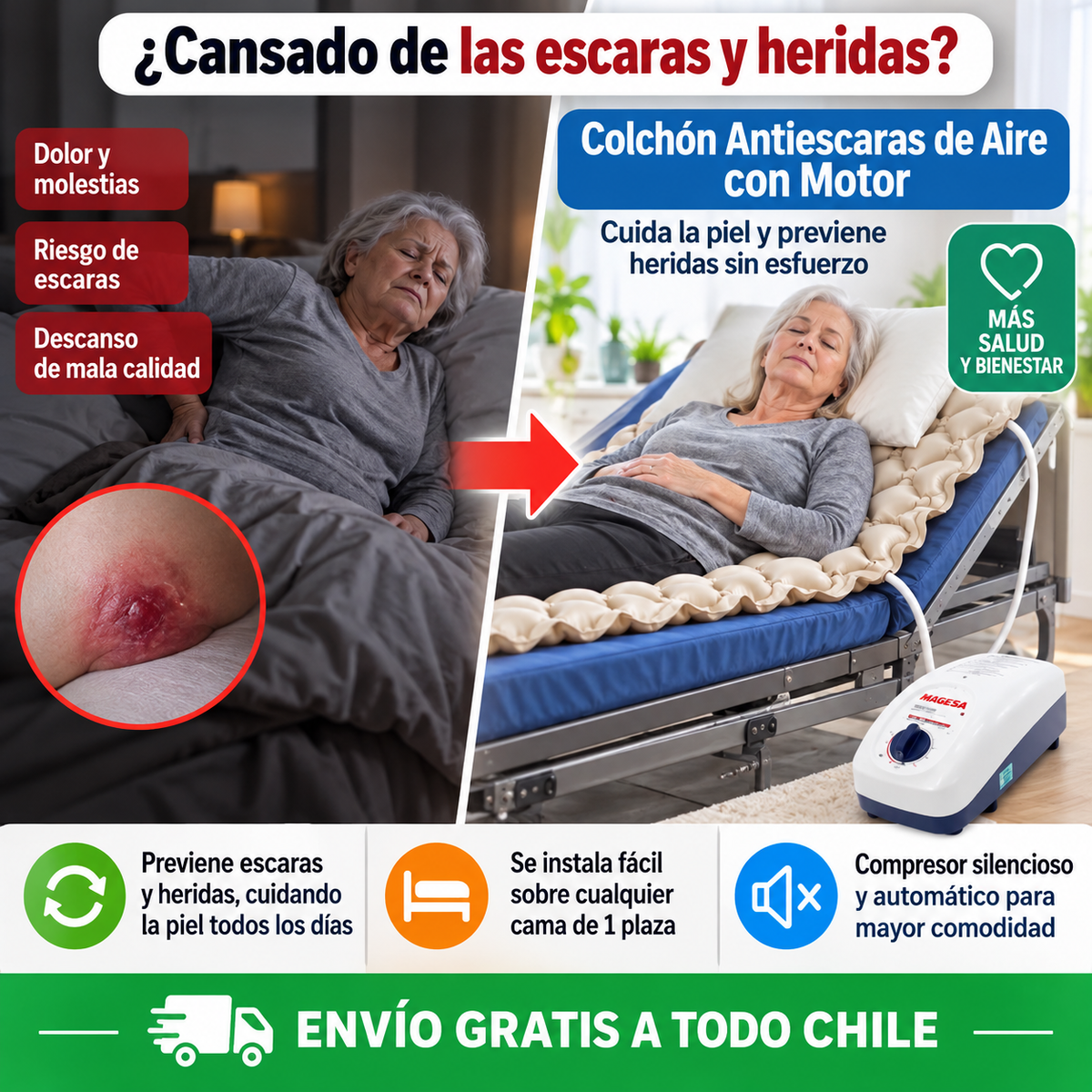 Colchón Antiescaras de Aire con Motor – Cuida la piel y previene heridas sin esfuerzo